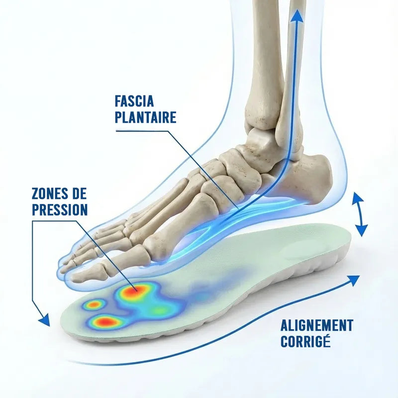 Semelle Orthopédiques -  My Sole